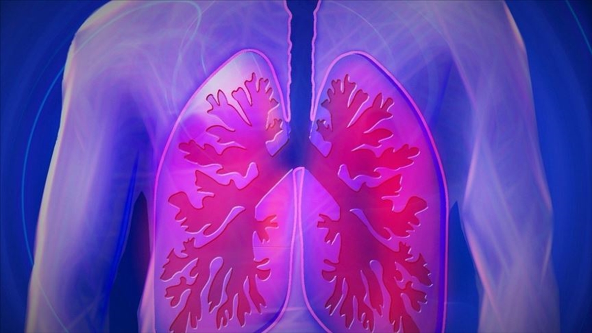 Akciğer kanserinde erken teşhis başarı şansını artırıyor